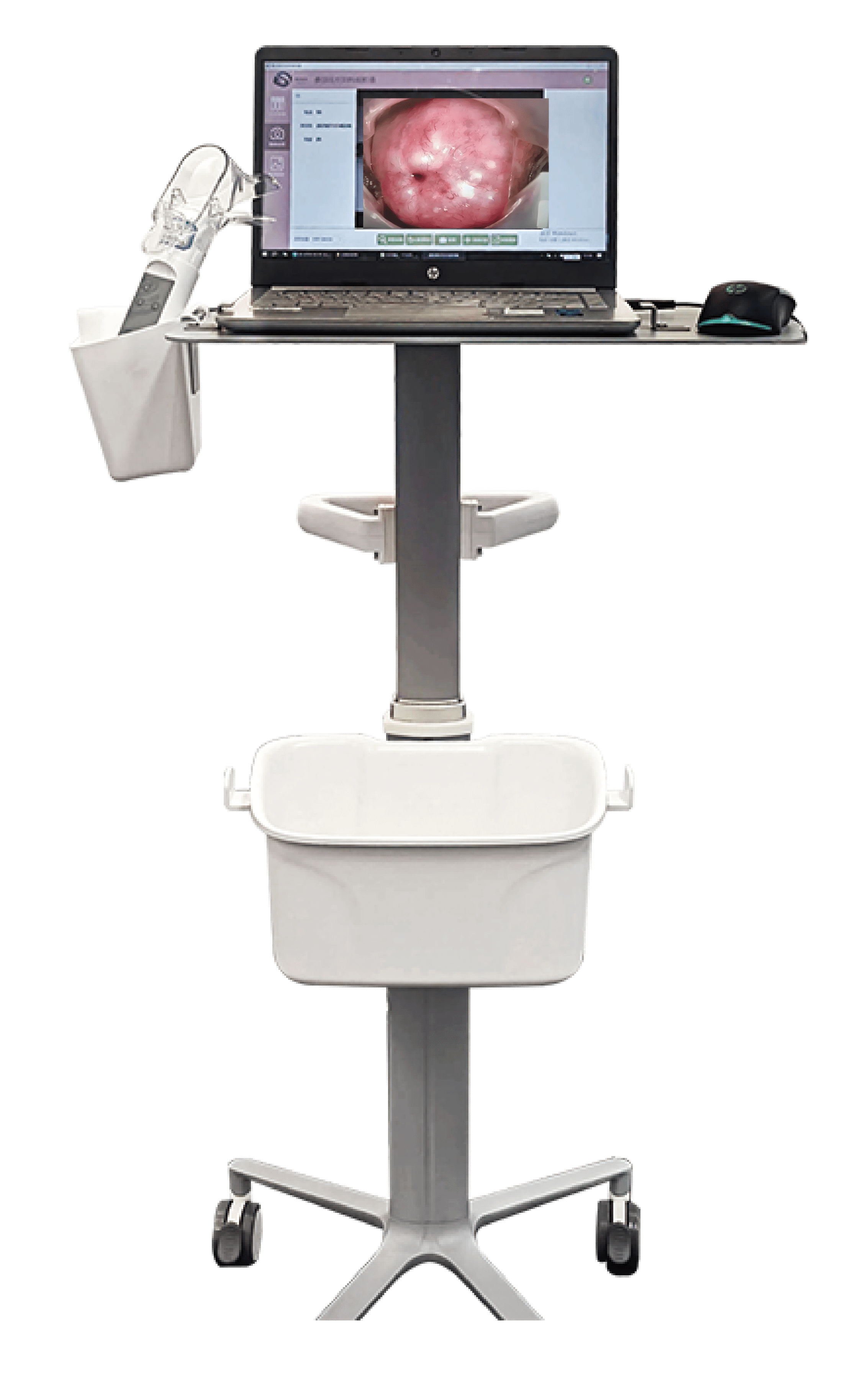 Portable Electronic Colposcope